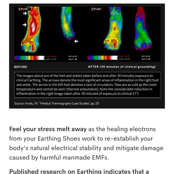 Grounding & Earthing Barefoot Ankle Strap
Sandals for Women - Picture 11 of 12